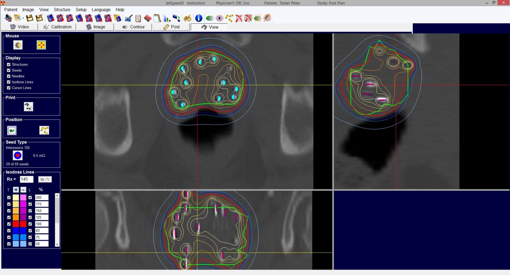 LDR Brachytherapy Software JetSpeed5 Steuerungsprogramm